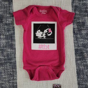 Sara Kety Ultrasound Meme Onesie (up to 6 months)